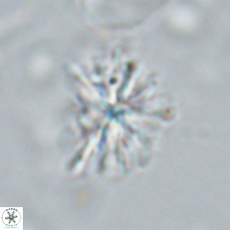 Sphenolithus grandis VR 16736