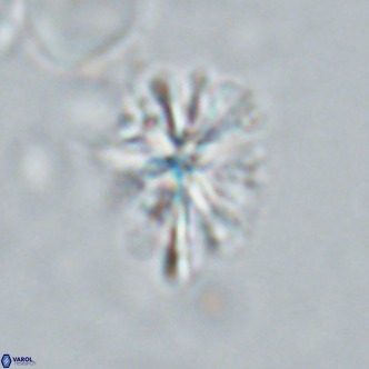 Sphenolithus grandis VR 16737