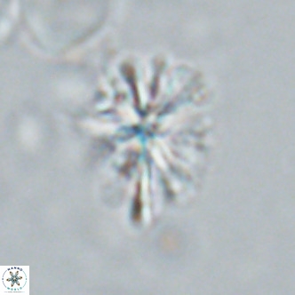 Sphenolithus grandis VR 16737