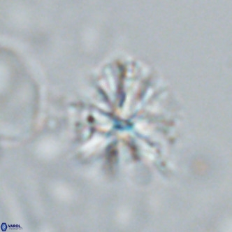Sphenolithus grandis VR 16738