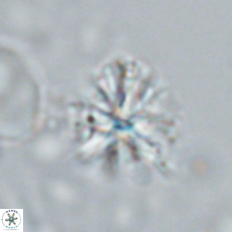 Sphenolithus grandis VR 16738