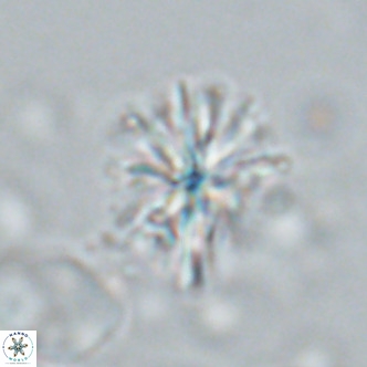 Sphenolithus grandis VR 16739