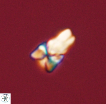 Sphenolithus didymikoryfi 54211