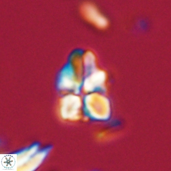 Sphenolithus didymikoryfi 65104