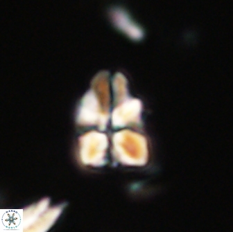 Sphenolithus didymikoryfi 65105