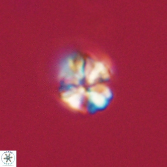 Sphenolithus didymikoryfi 65107