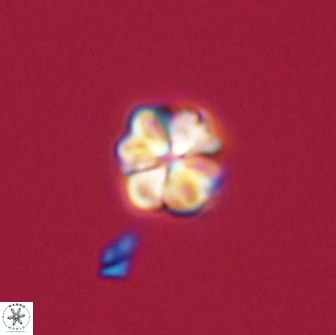 Sphenolithus didymikoryfi 65108