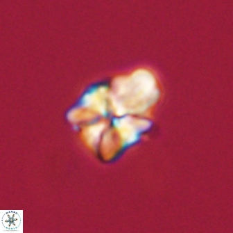 Sphenolithus didymikoryfi 65115