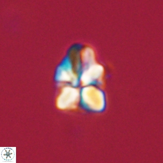 Sphenolithus didymikoryfi 65111