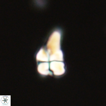 Sphenolithus didymikoryfi 68947