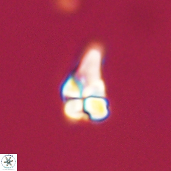 Sphenolithus didymikoryfi 68948