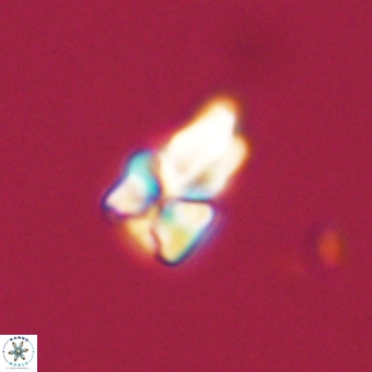 Sphenolithus didymikoryfi 68956