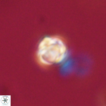 Sphenolithus didymikoryfi 68958