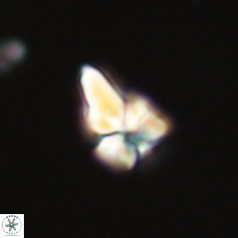 Sphenolithus didymikoryfi 68950