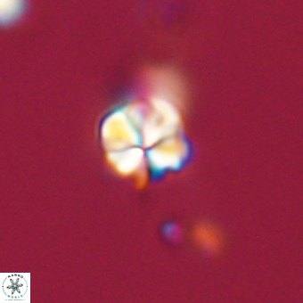 Sphenolithus didymikoryfi 68964