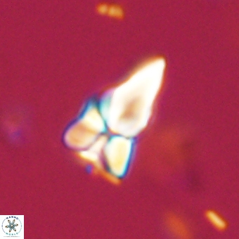 Sphenolithus didymikoryfi 69124