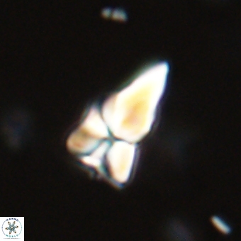 Sphenolithus didymikoryfi 69125