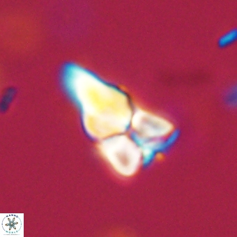 Sphenolithus didymikoryfi 69128
