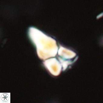 Sphenolithus didymikoryfi 69129