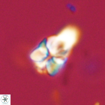 Sphenolithus didymikoryfi 69123