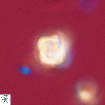 Sphenolithus didymikoryfi 69139