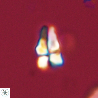 Sphenolithus didymikoryfi 69612