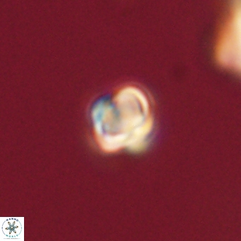 Sphenolithus didymikoryfi 69629
