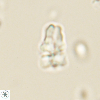 Sphenolithus didymikoryfi 69620