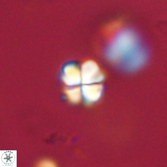 Sphenolithus didymikoryfi 69631