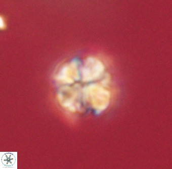 Sphenolithus didymikoryfi 62305