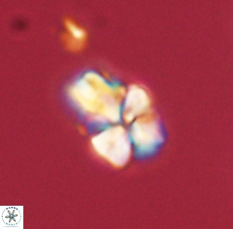 Sphenolithus didymikoryfi 62306