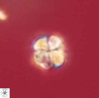 Sphenolithus didymikoryfi 62303