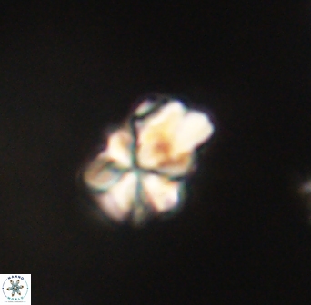 Sphenolithus didymikoryfi 62316