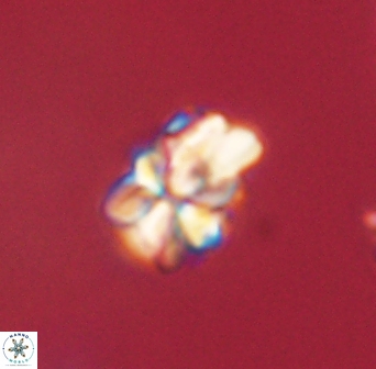 Sphenolithus didymikoryfi 62317