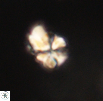 Sphenolithus didymikoryfi 62312