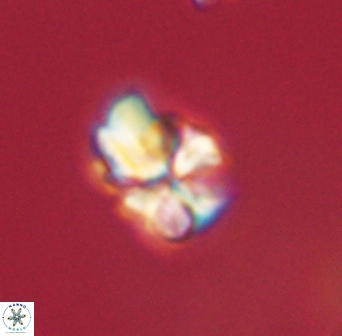 Sphenolithus didymikoryfi 62313