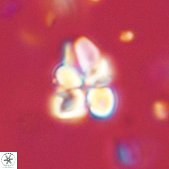 Sphenolithus didymikoryfi 70832