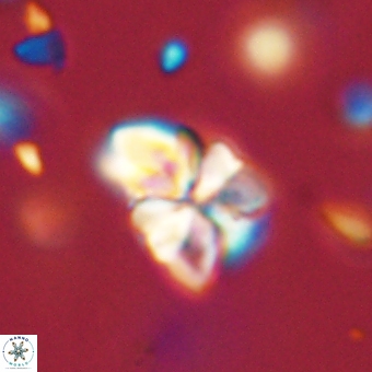 Sphenolithus didymikoryfi 70833
