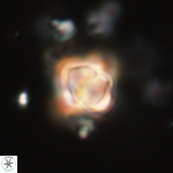 Sphenolithus didymikoryfi 70846