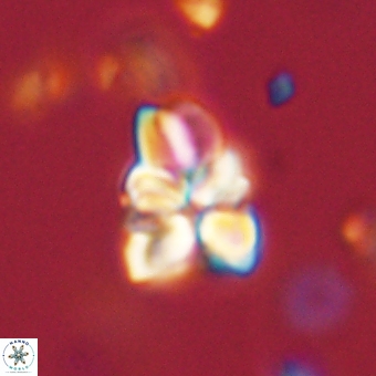 Sphenolithus didymikoryfi 70840