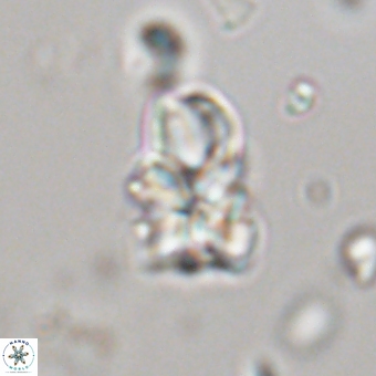 Sphenolithus didymikoryfi 70841
