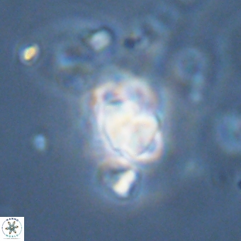 Sphenolithus didymikoryfi 70843