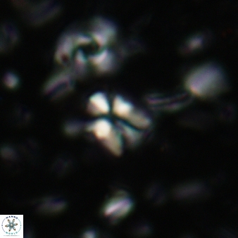 Sphenolithus disbelemnos 105