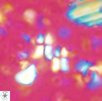 Sphenolithus disbelemnos 27848