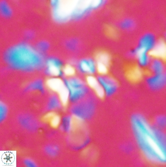 Sphenolithus disbelemnos 27849