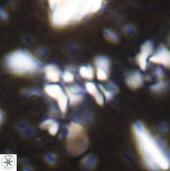 Sphenolithus disbelemnos 27850