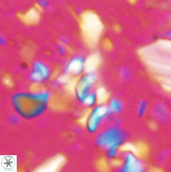 Sphenolithus disbelemnos 27851