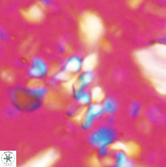 Sphenolithus disbelemnos 27852
