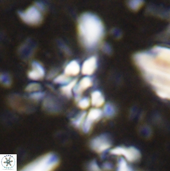 Sphenolithus disbelemnos 27853