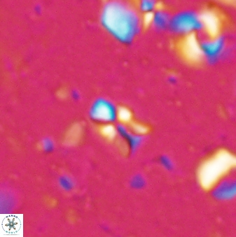 Sphenolithus disbelemnos 27858